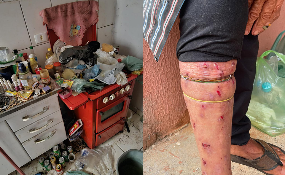 idosa surto psiquiátrico em anapolis