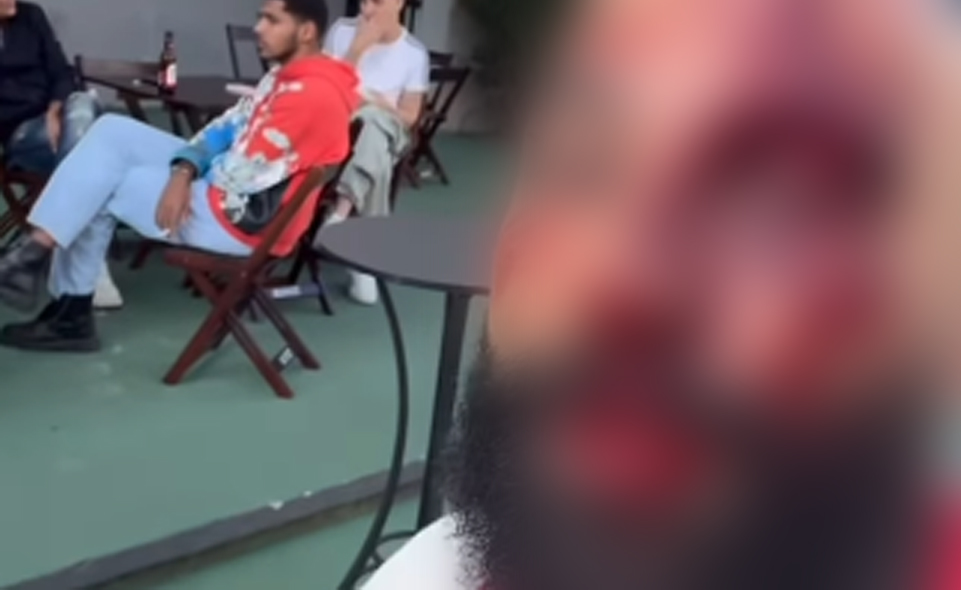 Arquiteto de Anápolis denuncia agressão em boate do Setor Sul, em Goiânia; imagens são fortes