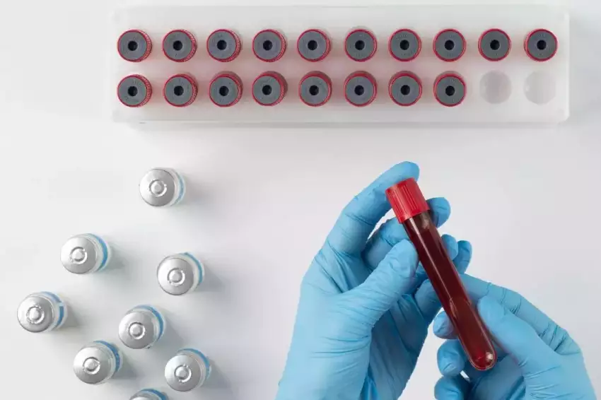 Nova tecnologia com RNA mensageiro reativa vírus latente e aponta caminho para possível cura do HIV