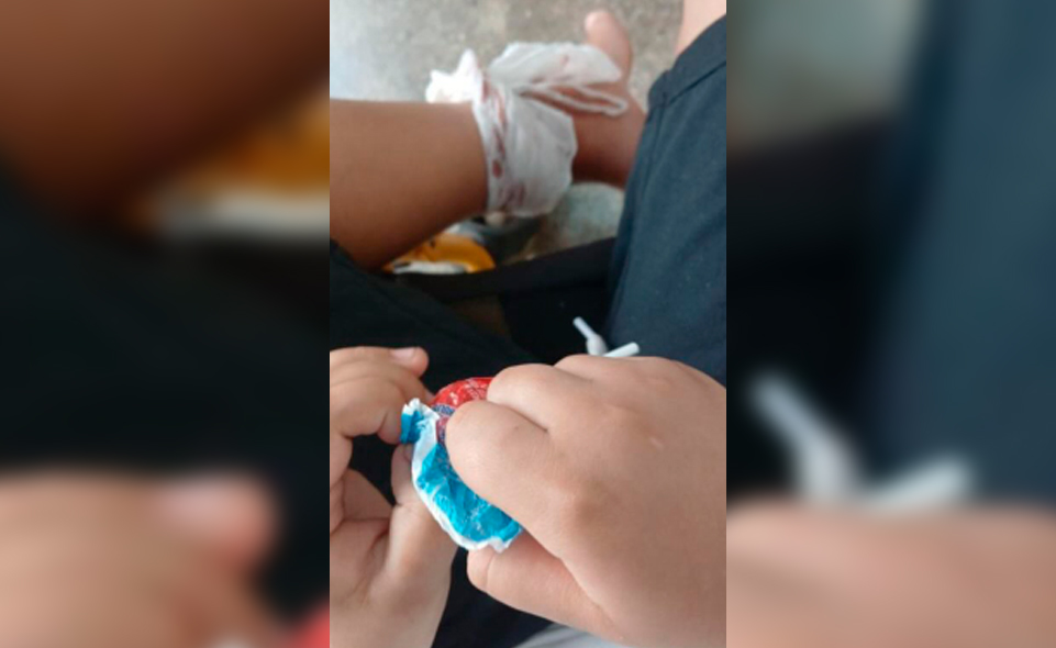 Menino de 10 anos é mordido por macaco em parque de Anápolis