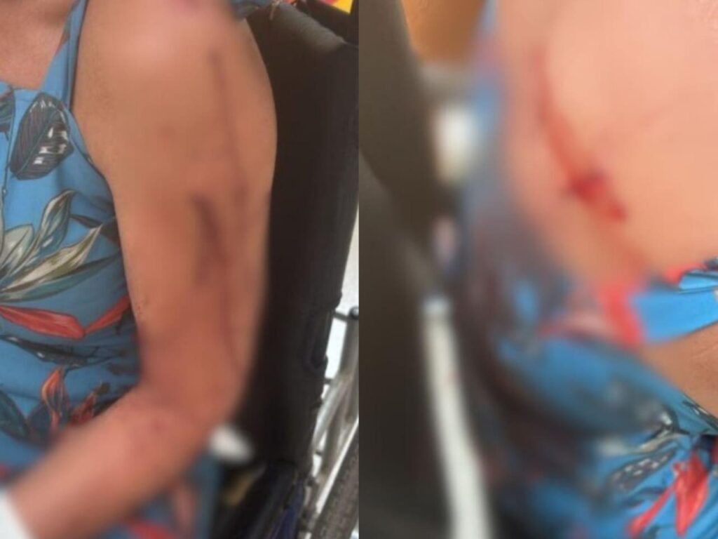 Professora é esfaqueada por aluna de 14 anos em escola municipal de Valparaíso de Goiás