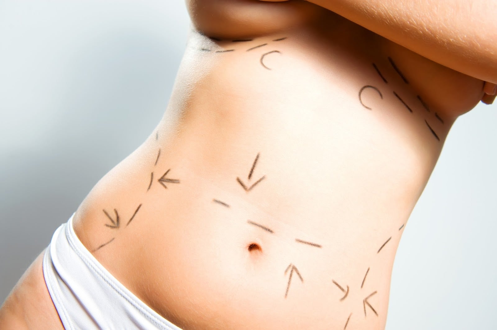 Cirurgia estética