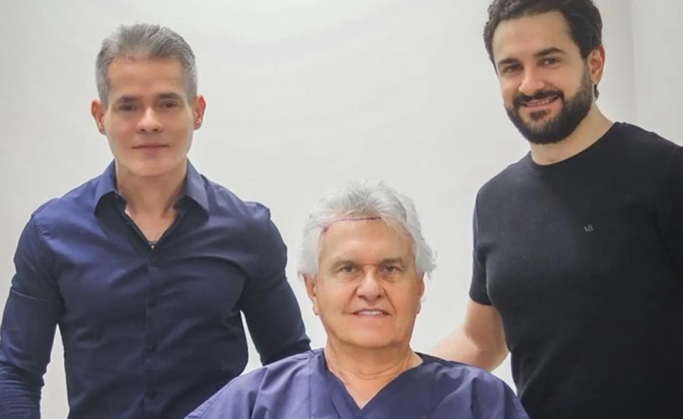 Ronaldo Caiado transplante capilar