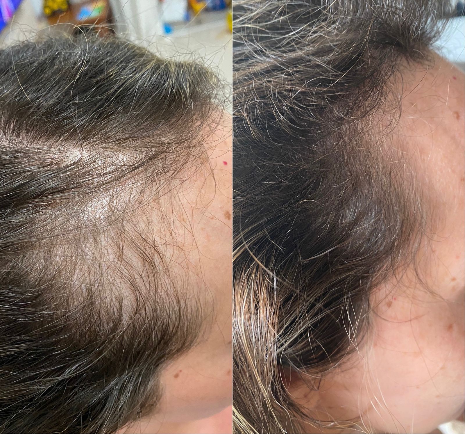 Tratamentos Capilares - confira o antes e depois (1)